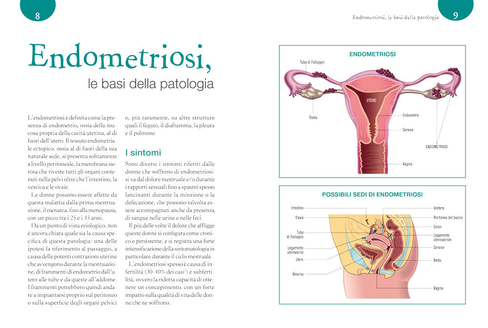La dieta anti Endometriosi. L'alimentazione antiinfiammatoria per ridurre i sintomi e vivere meglio